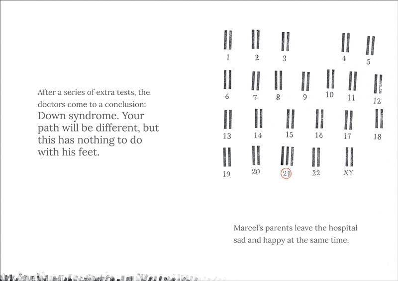  Little black vertical lines are stamped across the very bottom of the page on the left. On the right, chromosomes, represented by pairs of black lines, are arranged across the page. Below each chromosome is a number from one to twenty-two. The twenty-first chromosome has three lines instead of two, and the final chromosome has the letters 'XY' beneath it instead of a number. Text reads Marcel has down syndrome, which has nothing to do with his feet. Marcel’s parents leave the hospital both sad and happy. 